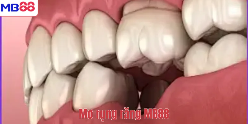 Mơ Thấy Rụng Răng Có Ý Nghĩa Gì? Giải Mã Điềm Báo Cùng MB88 1 Mơ thấy rụng răng MB88